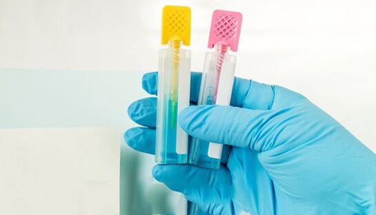 Metode de diagnosticare a parazitului